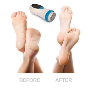 Silky Spin - Magic Foot Pedicure